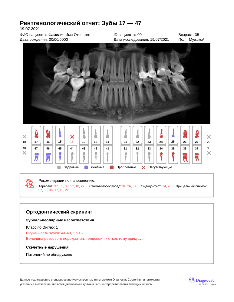 Обезличенный пример отчёта Diagnocat с зубной формулой